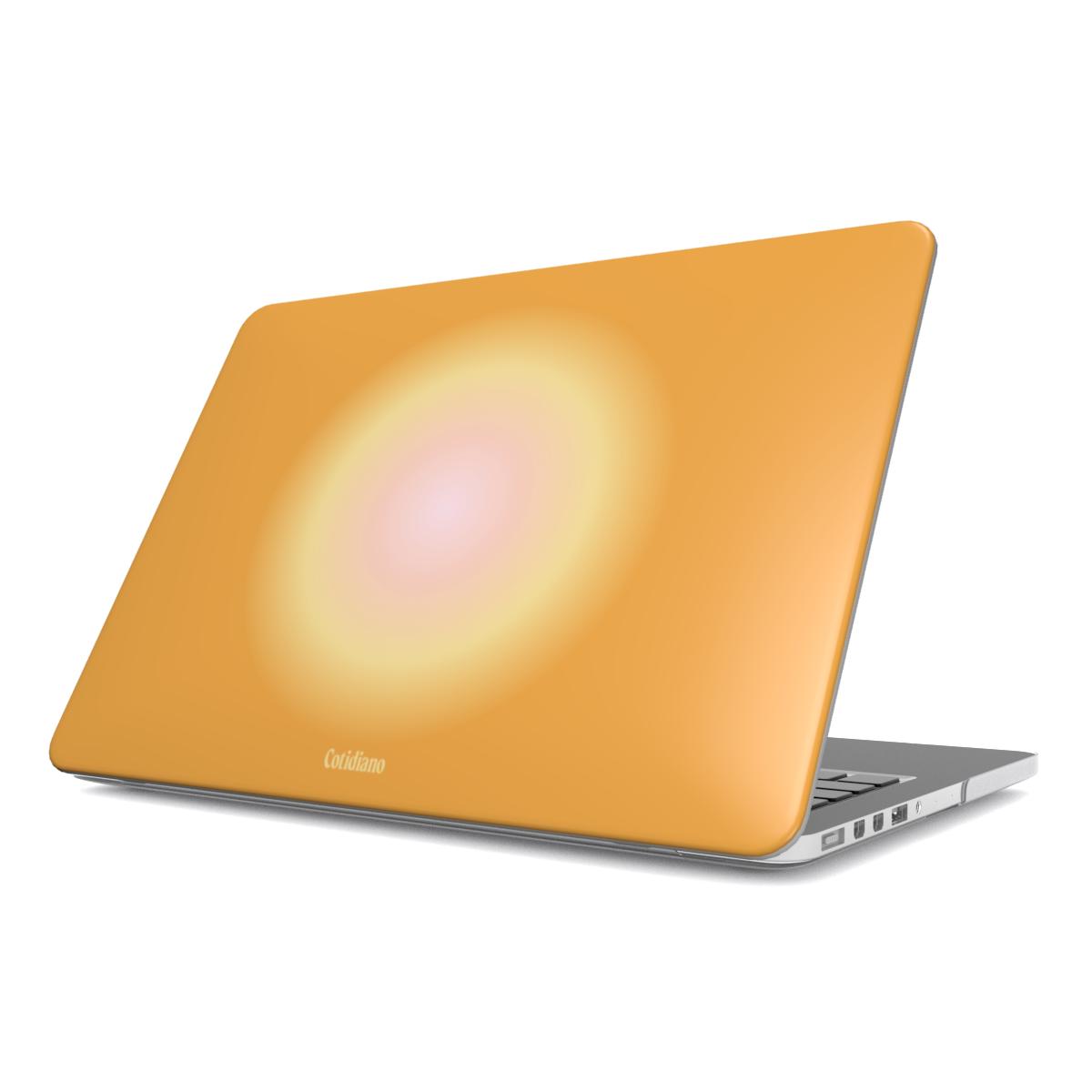 Aurora MacBook Case